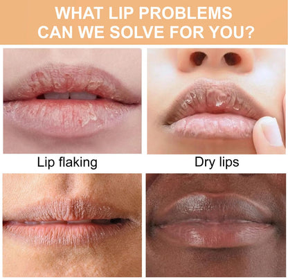 Turmeric Lip Balm for Smokers With Root Oil - Brightening for Dark Lips, Long-Lasting Moisturizer for Dry - Maple Wellness Supplements