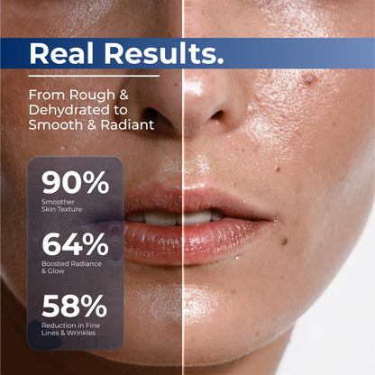 TURMSKIN® Hyaluronic Acid Serum Ampoules [ULTRA HYDRATING VIALS] - 3% Hyaluron Booster for Glass Skin & Anti Aging - 24 Hours Hydration - Maple Wellness Supplements