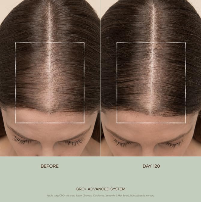 VEGAMOUR GRO+ Advanced Balancing Shampoo and Conditioner Kit | Removes Buildup, Hydrates the Scalp and Softens Strands | For Severe Signs of Thinning | Color Safe, Vegan, Cruelty-Free (8 Fl Oz each) - Maple Wellness Supplements