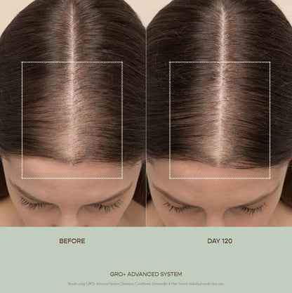 VEGAMOUR GRO+ Advanced Balancing Shampoo and Conditioner Kit | Removes Buildup, Hydrates the Scalp and Softens Strands | For Severe Signs of Thinning | Color Safe, Vegan, Cruelty-Free (8 Fl Oz each) - Maple Wellness Supplements