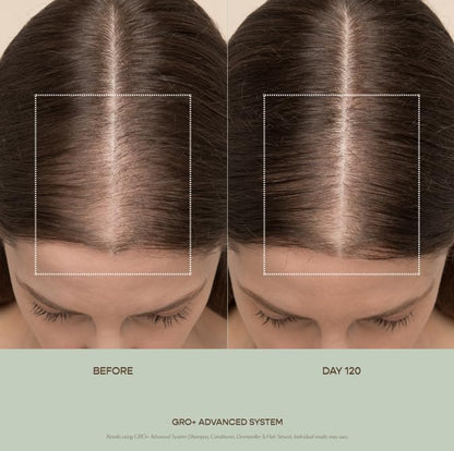 VEGAMOUR GRO+ Advanced Hair Serum for Improving Hair Density, Tonic Reduces Shedding and Promotes a Healthy Scalp, 3 pack - Maple Wellness Supplements
