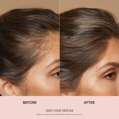 VEGAMOUR GRO Healthy Hair Starter Kit | Full Size GRO Serum for Thinning & Shedding plus Travel Size Shampoo and Conditioner with Vegan Keratin to Support Thicker, Fuller Looking Locks | $92 Value - Maple Wellness Supplements