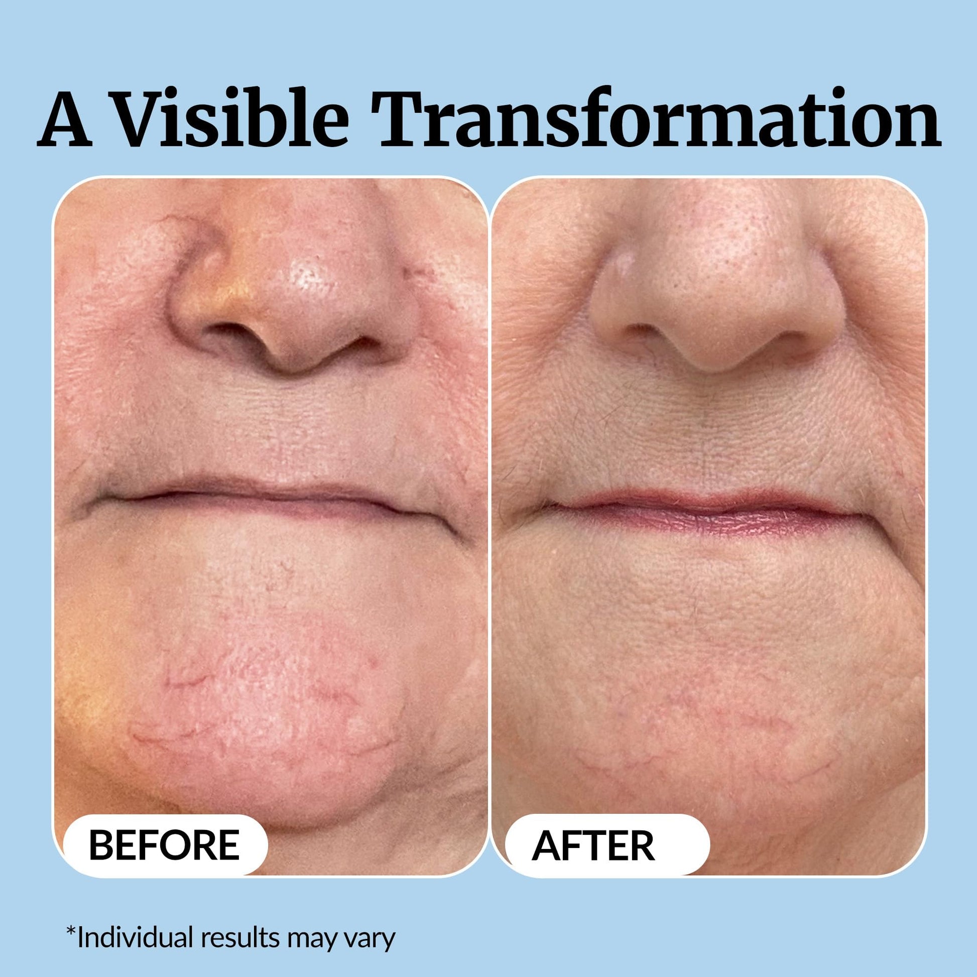Vibriance Super C Serum for Mature Skin - All-in-One Vitamin Formula Hydrates, Firms, - Maple Wellness Supplements