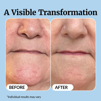 Vibriance Super C Serum for Mature Skin - All-in-One Vitamin Formula Hydrates, Firms, - Maple Wellness Supplements