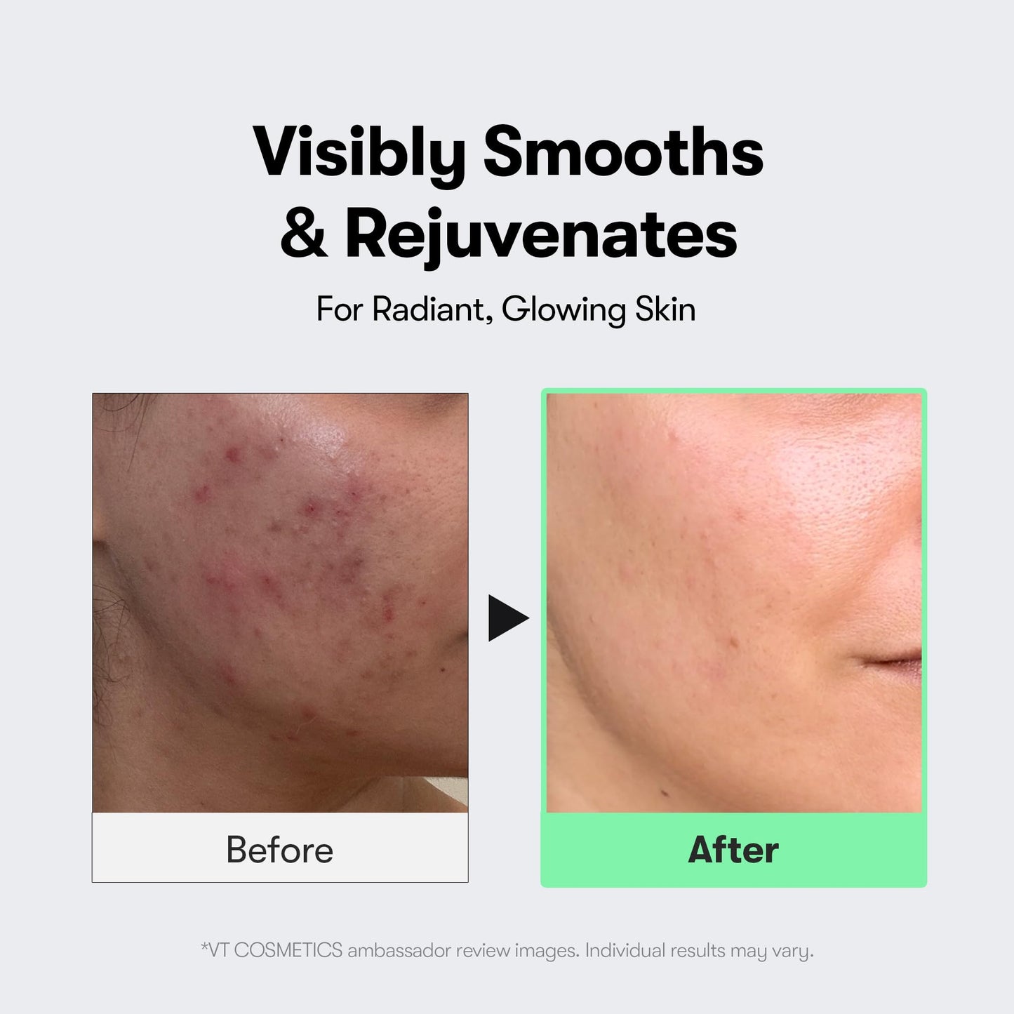 VT COSMETICS CICA Reedle Shot 100, Spicule Microneedling Serum for Pore Care & Exfoliation, Exosome, Centella Asiatica for Glass Skin - Maple Wellness Supplements