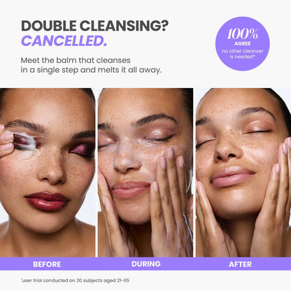 Wonderskin Cleansing Balm - Melt It All Balm to Milk Makeup Remover, Gentle Hydrating Face Cleanser with Centella and Chamomile - Maple Wellness Supplements