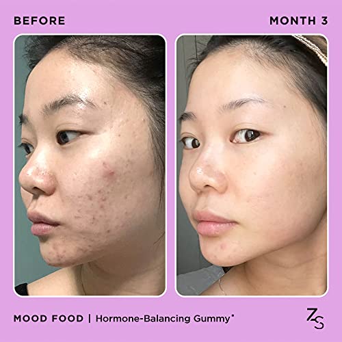 ZitSticka Mood Food: Gummy for Moody Skin + PMS Drama, Forest Berry Flavour - Maple Wellness Supplements